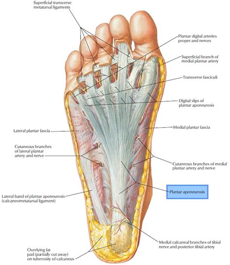 Diagram of plantar fasciitis pain in the heel and arch