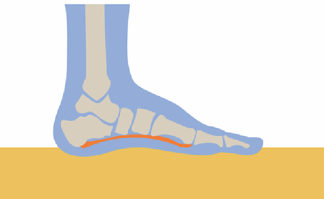 Plantar fascia anatomy showing the thick band from heel to toe