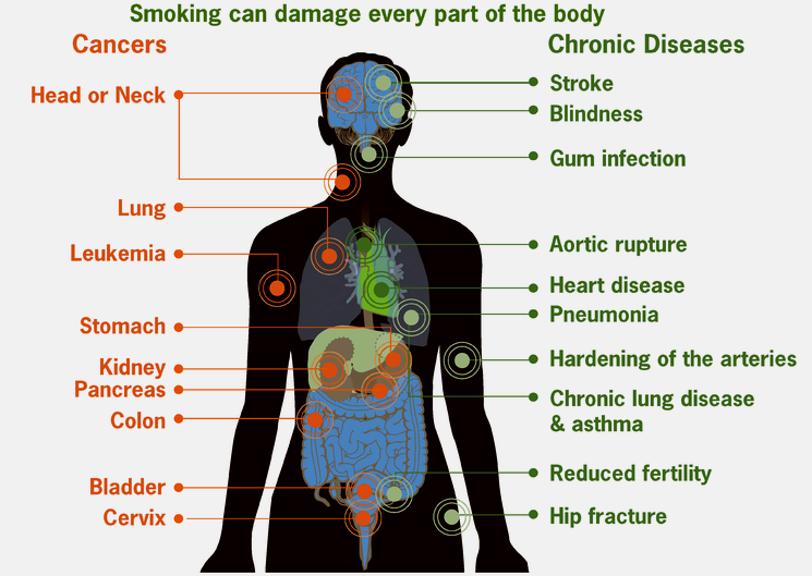 benefits of quitting smoking after 60 — illustration 3 from Doug Jones' original Garden Island column